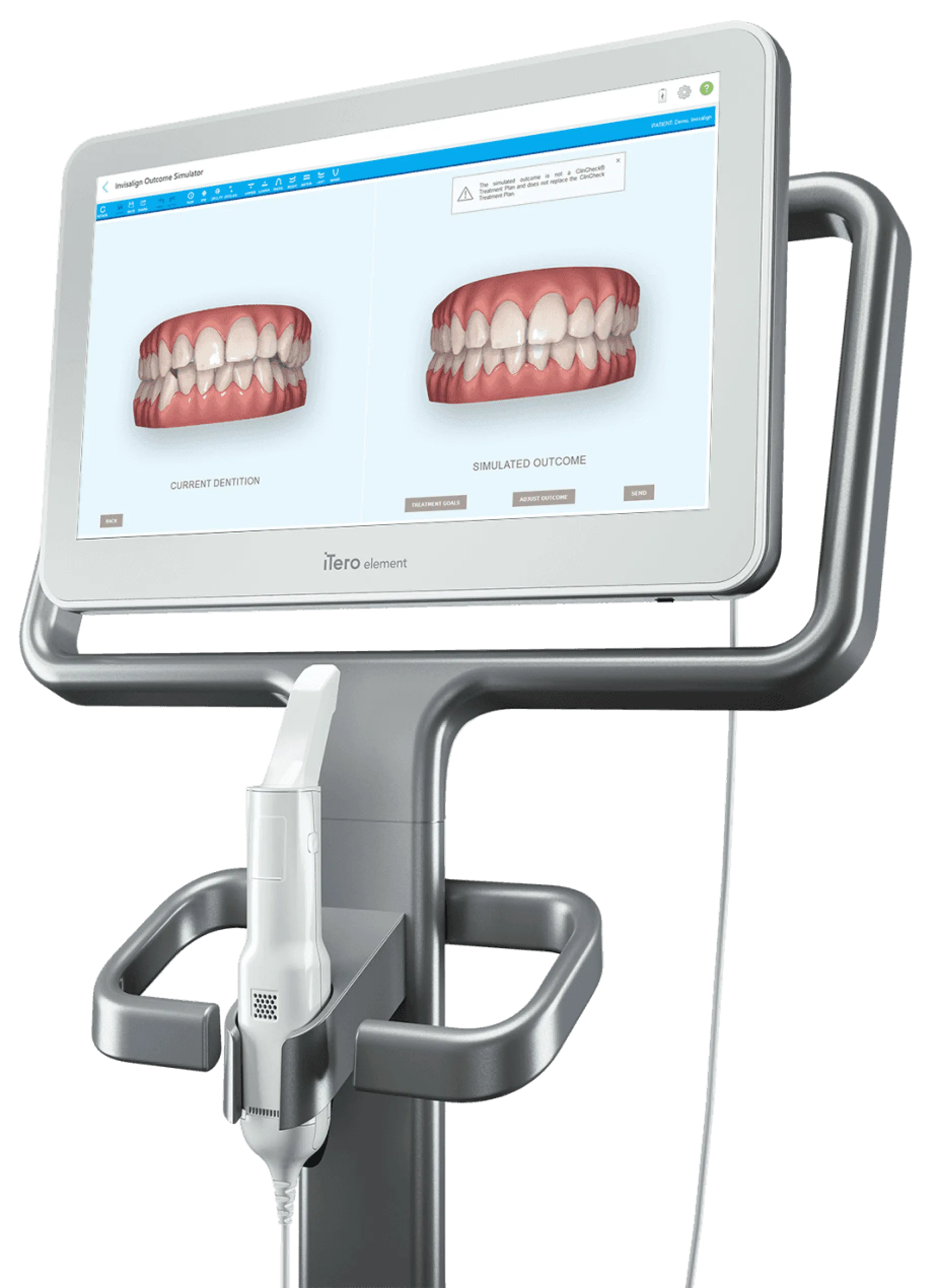 Imagem de um iTero, um scanner digital utilizado pela Dra. Bruna Rabaioli, especialista em Invisalign, para simular o resultado do tratamento ortodôntico. A tela exibe uma comparação entre a dentição atual e o resultado simulado.